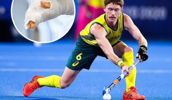 Αυστραλός αθλητής ακρωτηρίασε το δάκτυλό του για να παίξει στους Ολυμπιακούς Αγώνες 2024