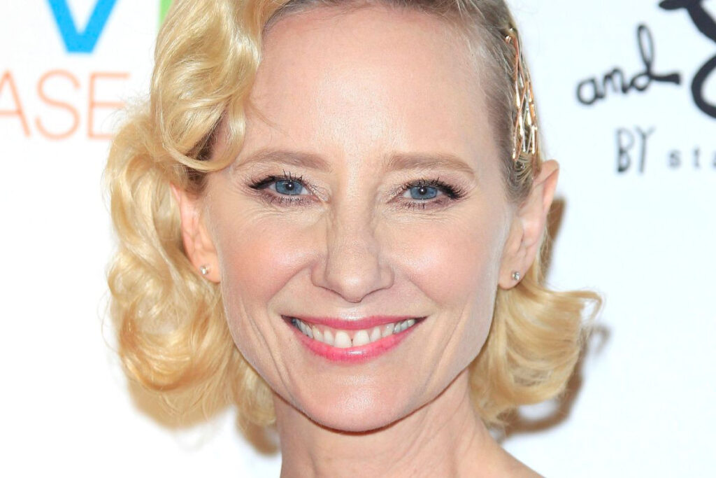 Anne Heche: O ιατροδικαστής αποκάλυψε την αιτία θανάτου της