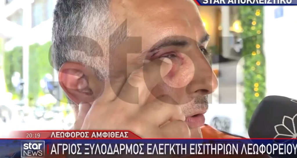 Ξυλοδαρμός ελεγκτή εισιτηρίων μέσα σε λεωφορείο, «με δάγκωσαν»